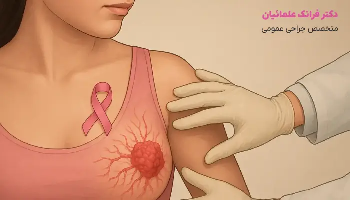 سرطان سینه