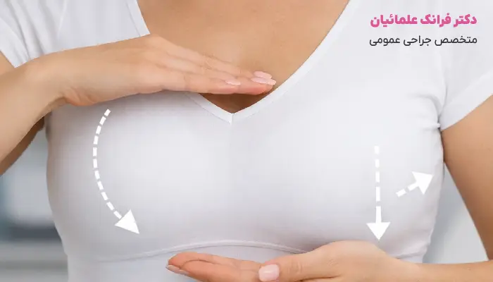 ماموپلاستی