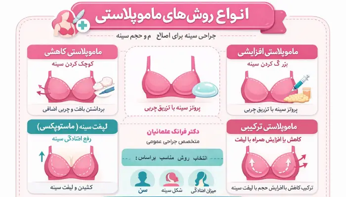 ماموپلاستی