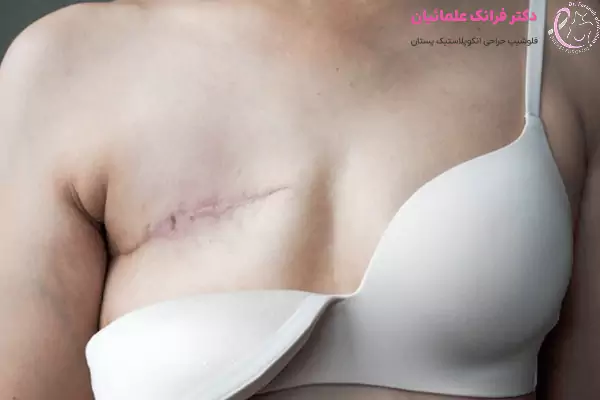 قیمت جراحی سرطان سینه