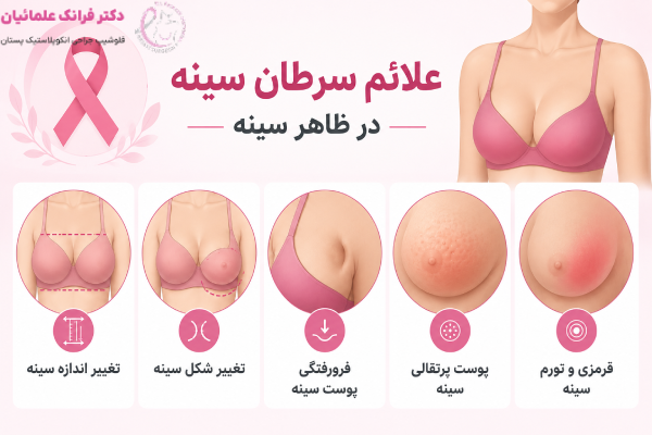 علائم سرطان سینه در ظاهر سینه